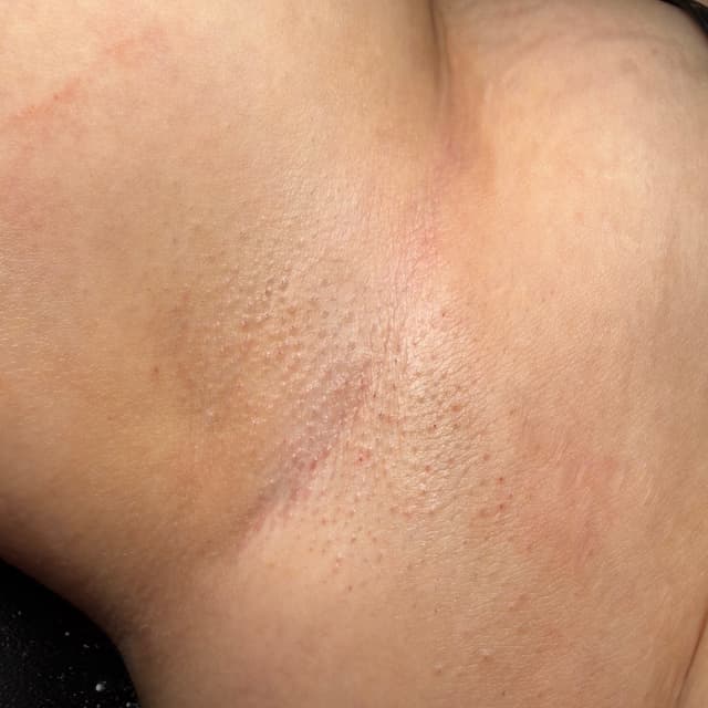 6 Visit Underarm Package at WaxdByArianaMichelle in Latham, NY